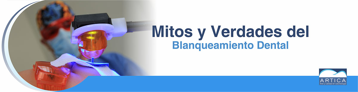 Mitos-del-Blanqueamiento-Dental