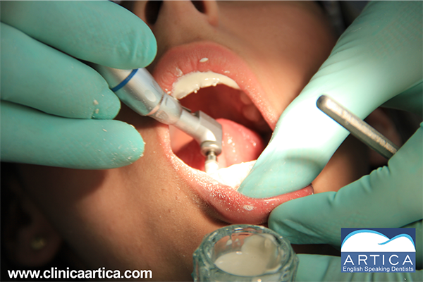 Dental-Whitening-Medellin-3