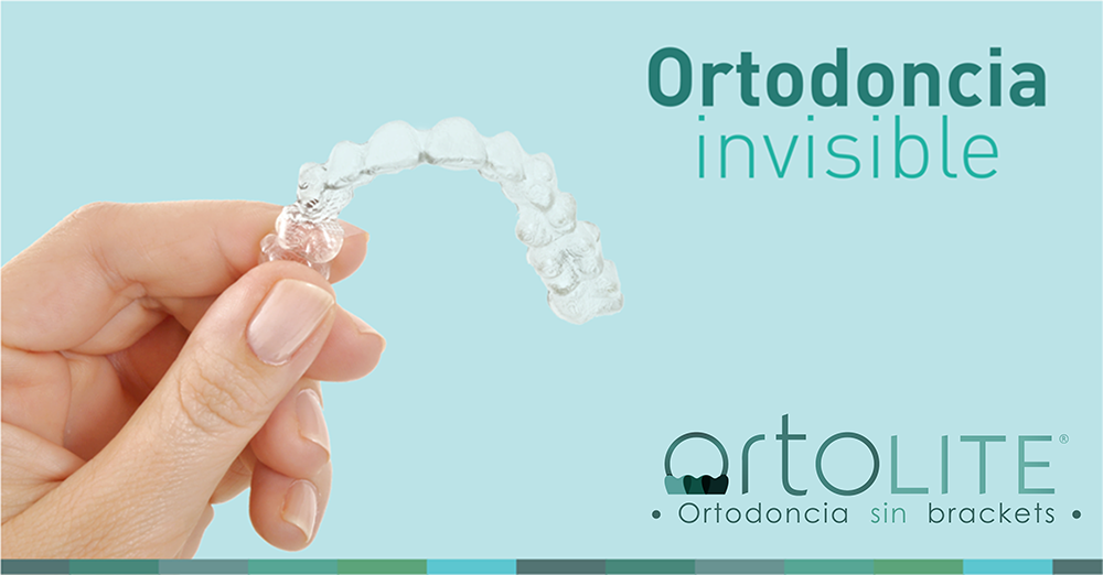 Ortodoncia-invisible-ortolite-1