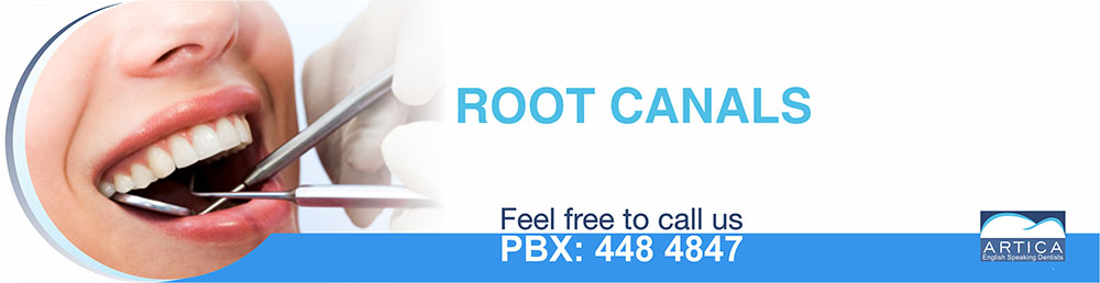 Root-Canals-medellin