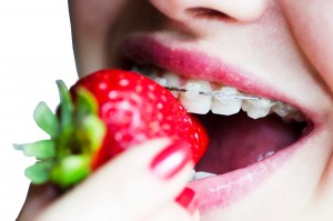 Foods-to-Avoid-with-Braces2