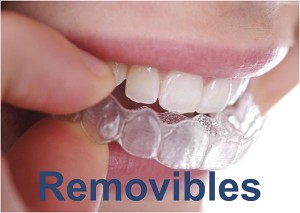Ortodoncia-Removible