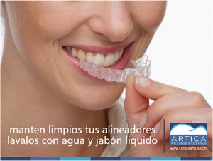 Ortodoncia-sin-brackets