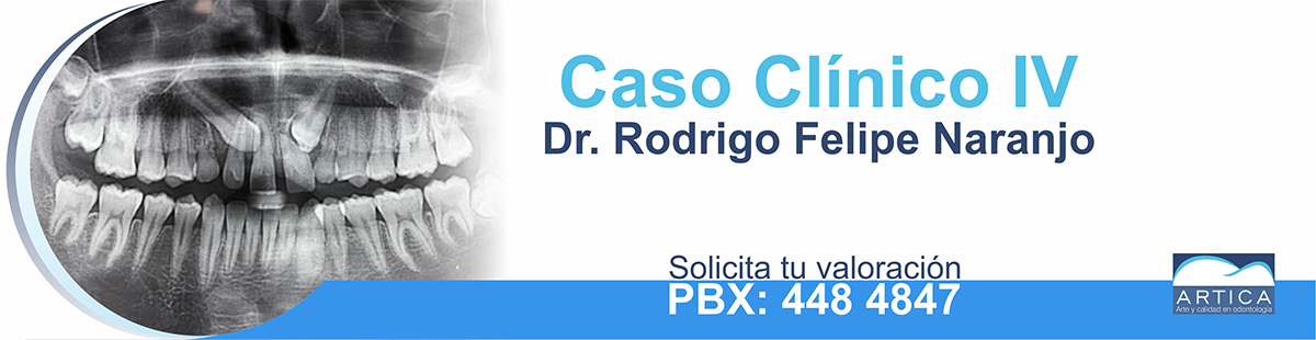 Caso-Clinico-4-Felipe-Naranjo