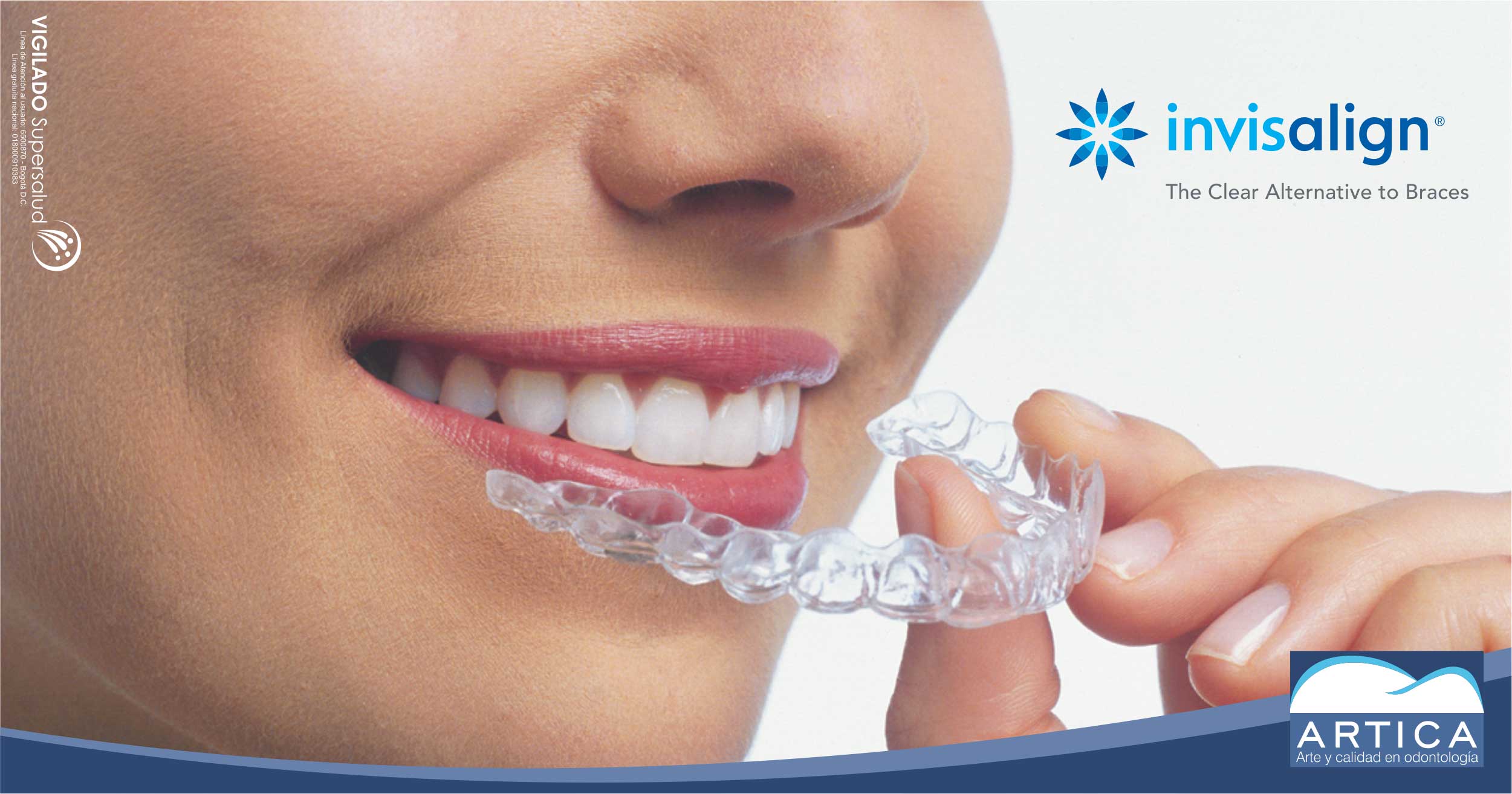 Invisalign-webblog