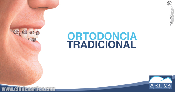 Ortodoncia-Tradicional
