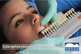 Dental-whitening-dental-check-up
