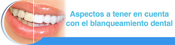 Blanqueamiento-dental-aspectos-a-tener-en-cuenta
