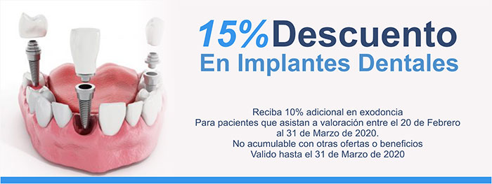 Descuento-en-implantes-dentales