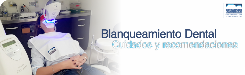 Cuidados y recomendaciones blanqueamiento dental