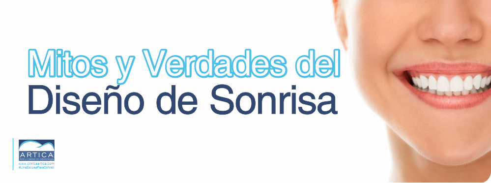 Diseño de sonrisa 3