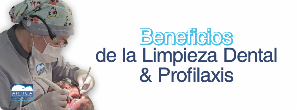 Beneficios de la limpieza dental