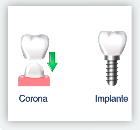 Implantes 1