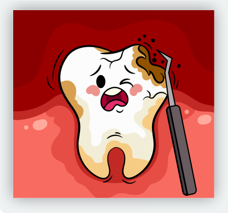 Caries dental