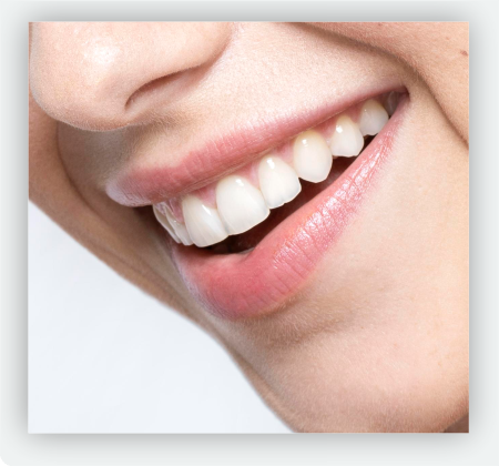 Resinas Clinica Artica 3