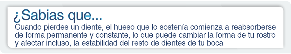 Consecuencias de no reemplazar un diente 4