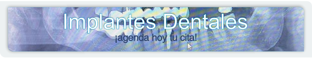 Que es la ortodoncia invisible 4