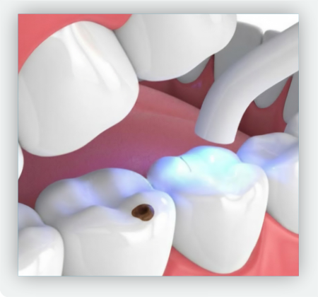 Dolor en los dientes 2