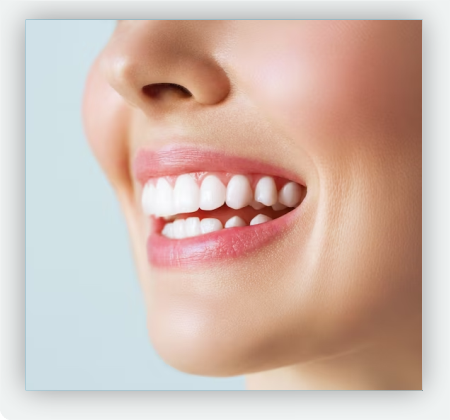 Carillas dentales medellin 4