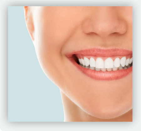 Carillas dentales medellin 5
