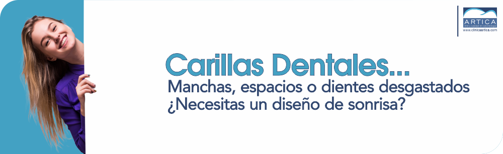 Carillas dentales medellin